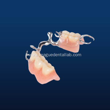 Metal Framework Partial Denture
